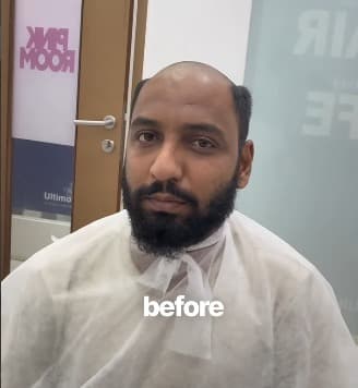 Before treatment